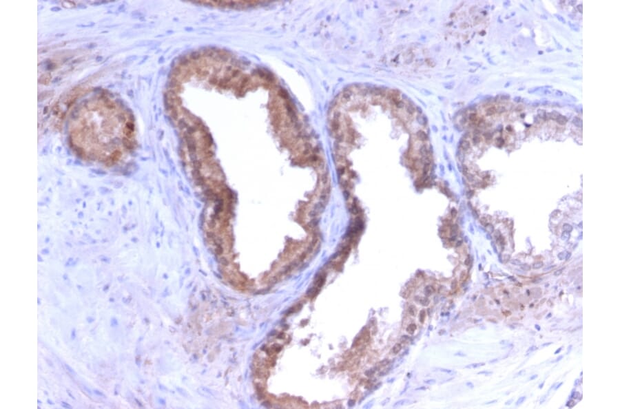 Immunohistochemistry - Anti-Prostate Specific Antigen Antibody [KLK3/2871R] (A249011) - Antibodies.com