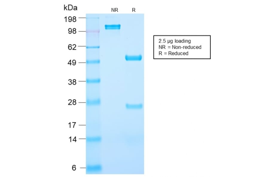 SDS-PAGE - Anti-Prostate Specific Antigen Antibody [KLK3/2871R] (A249011) - Antibodies.com