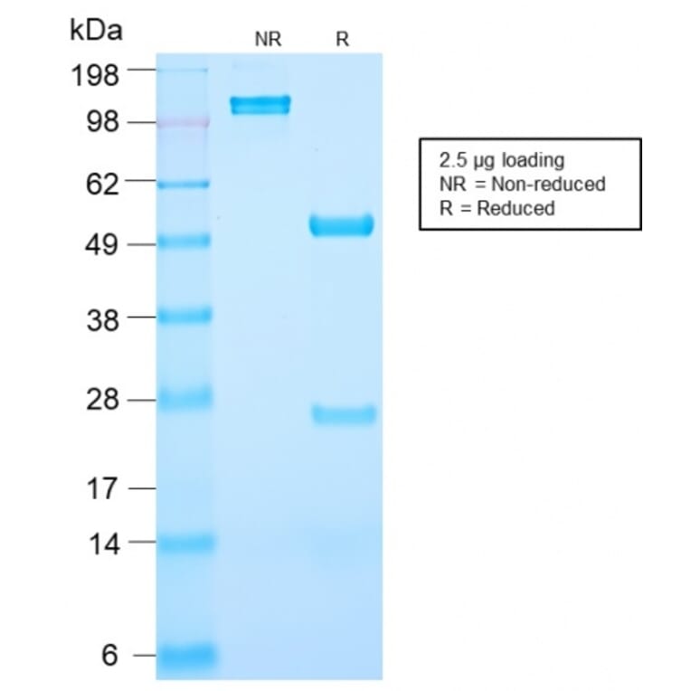 SDS-PAGE - Anti-Prostate Specific Antigen Antibody [KLK3/2871R] (A249011) - Antibodies.com