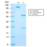 SDS-PAGE - Anti-Prostate Specific Antigen Antibody [KLK3/2871R] (A249011) - Antibodies.com