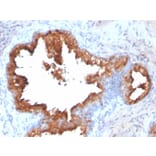 Immunohistochemistry - Anti-Prostate Specific Antigen Antibody [KLK3/2871R] (A249010) - Antibodies.com