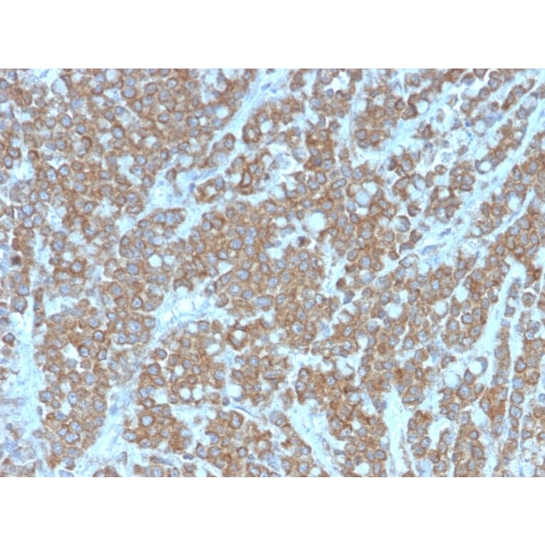 Immunohistochemistry - Anti-IL-1 alpha Antibody [IL1A/3981] (A249012) - Antibodies.com
