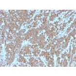 Immunohistochemistry - Anti-IL-1 alpha Antibody [IL1A/3981] (A249012) - Antibodies.com