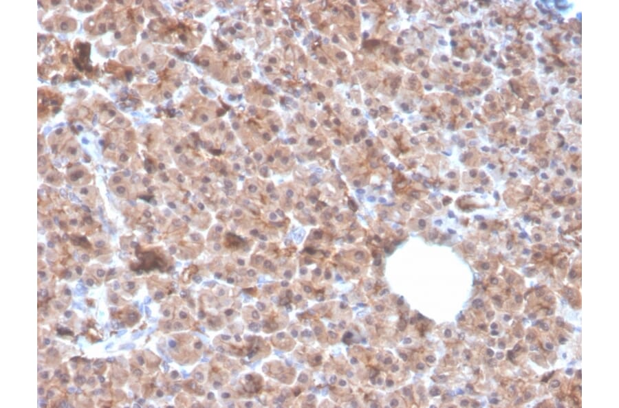 Immunohistochemistry - Anti-IL-1 alpha Antibody [IL1A/3982] (A249013) - Antibodies.com