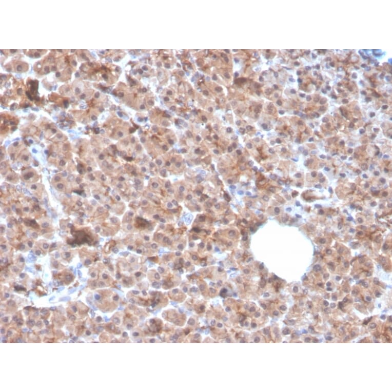 Immunohistochemistry - Anti-IL-1 alpha Antibody [IL1A/3982] (A249013) - Antibodies.com