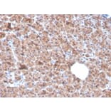 Immunohistochemistry - Anti-IL-1 alpha Antibody [IL1A/3982] (A249013) - Antibodies.com