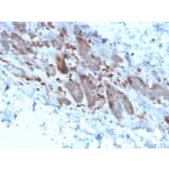 Immunohistochemistry - Anti-IL-1 alpha Antibody [IL1A/3982] (A249013) - Antibodies.com