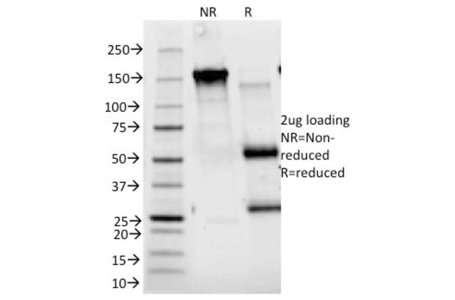 SDS-PAGE - Anti-IL2 Receptor alpha Antibody [143-13] (A249013) - Antibodies.com