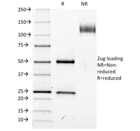 SDS-PAGE - Anti-IL2 Receptor alpha Antibody [IL2RA/423] (A249014) - Antibodies.com