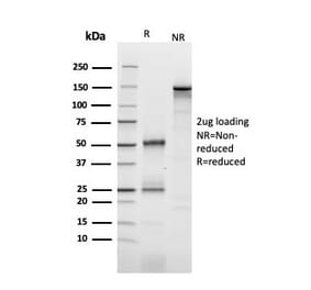 SDS-PAGE - Anti-IL2 Receptor alpha Antibody [IL2RA/2393] (A249016) - Antibodies.com