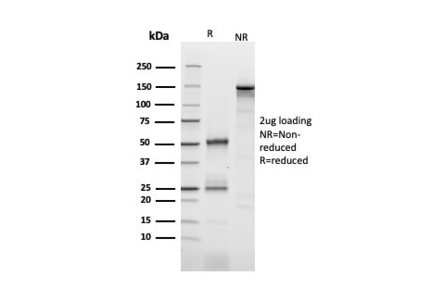 SDS-PAGE - Anti-IL2 Receptor alpha Antibody [IL2RA/2393] (A249016) - Antibodies.com