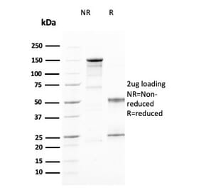 SDS-PAGE - Anti-IL2 Receptor alpha Antibody [IL2RA/2394] (A249017) - Antibodies.com