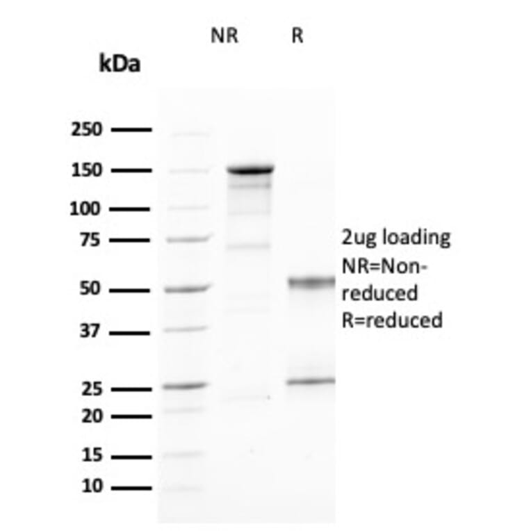 SDS-PAGE - Anti-IL2 Receptor alpha Antibody [IL2RA/2394] (A249017) - Antibodies.com