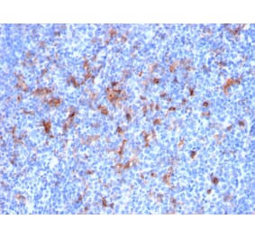 Immunohistochemistry - Anti-IL2 Receptor alpha Antibody [IL2RA/2395] (A249018) - Antibodies.com
