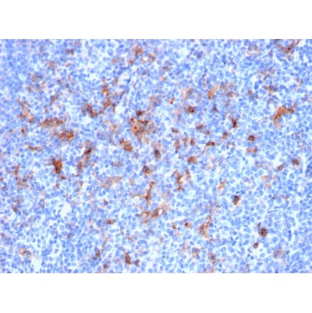 Immunohistochemistry - Anti-IL2 Receptor alpha Antibody [IL2RA/2395] (A249018) - Antibodies.com