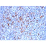 Immunohistochemistry - Anti-IL2 Receptor alpha Antibody [IL2RA/2395] (A249018) - Antibodies.com