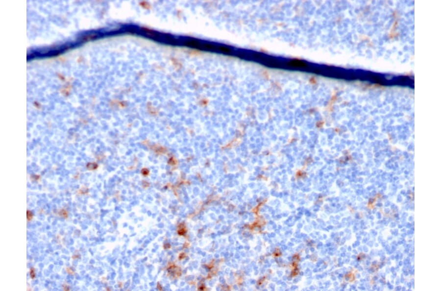 Immunohistochemistry - Anti-IL2 Receptor alpha Antibody [IL2RA/2395] (A249018) - Antibodies.com