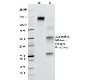 SDS-PAGE - Anti-Fas Antibody [B-R18] (A249018) - Antibodies.com