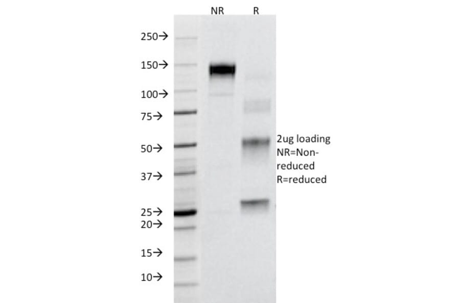 SDS-PAGE - Anti-Fas Antibody [B-R18] (A249018) - Antibodies.com