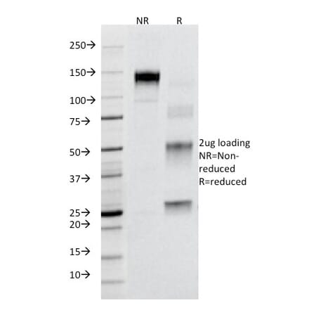 SDS-PAGE - Anti-Fas Antibody [B-R18] (A249018) - Antibodies.com