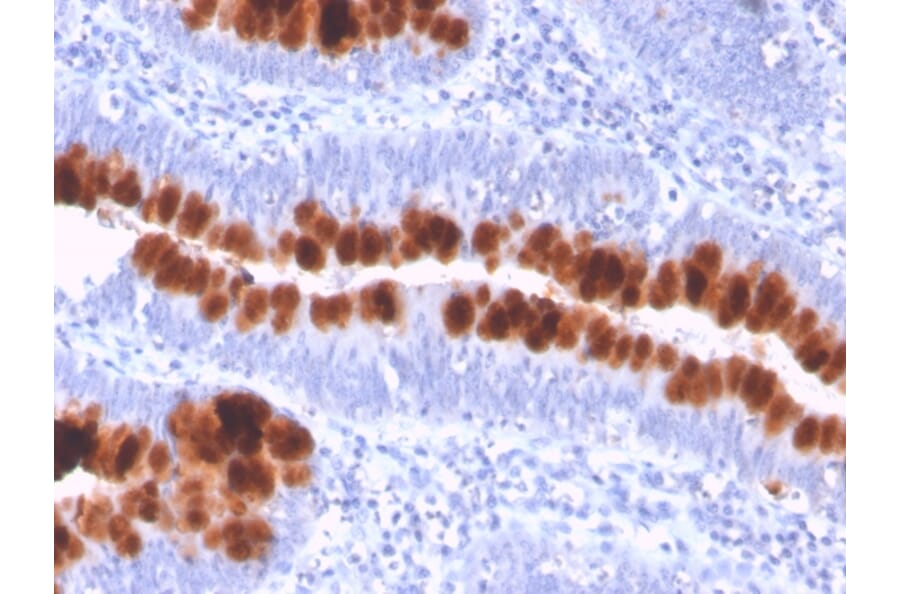 Immunohistochemistry - Anti-Fas Antibody [FAS/3112] (A249020) - Antibodies.com