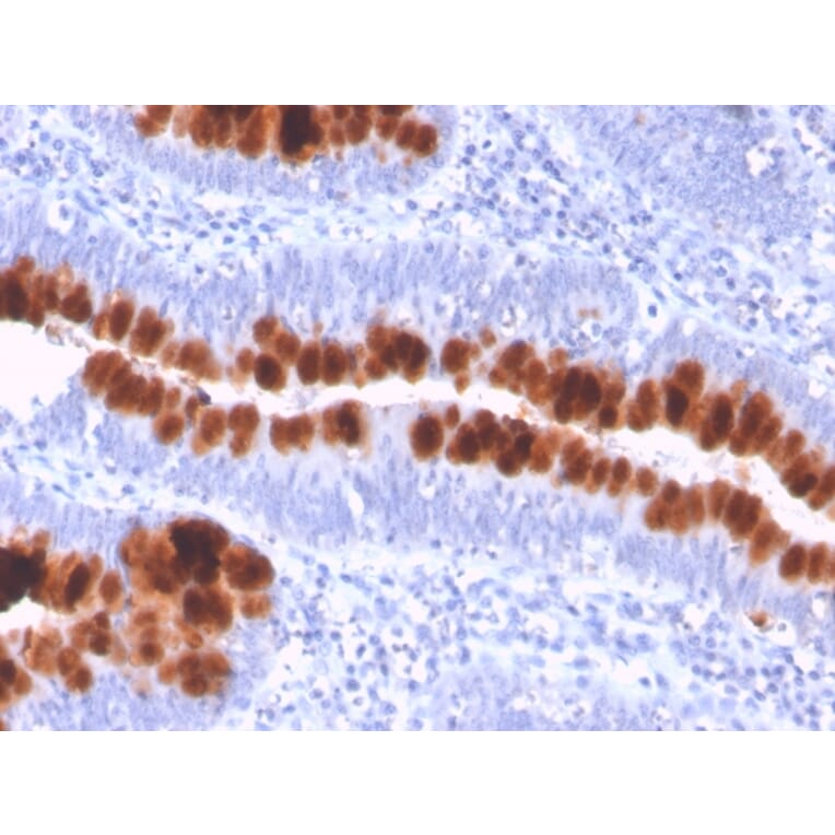 Immunohistochemistry - Anti-Fas Antibody [FAS/3112] (A249020) - Antibodies.com