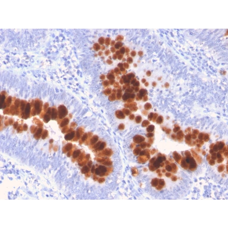 Immunohistochemistry - Anti-Fas Antibody [FAS/3112] (A249020) - Antibodies.com