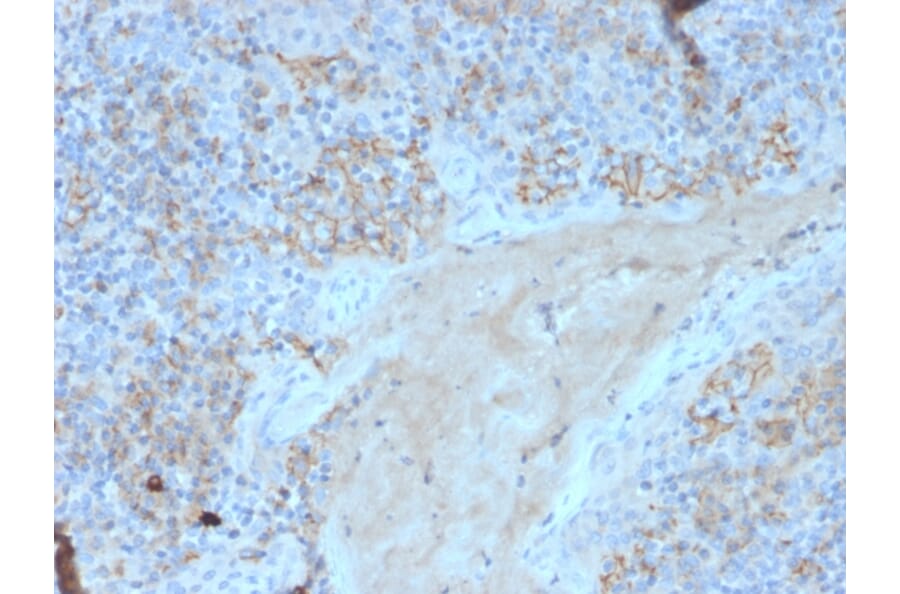 Immunohistochemistry - Anti-Fas Antibody [FAS/3588] (A249021) - Antibodies.com