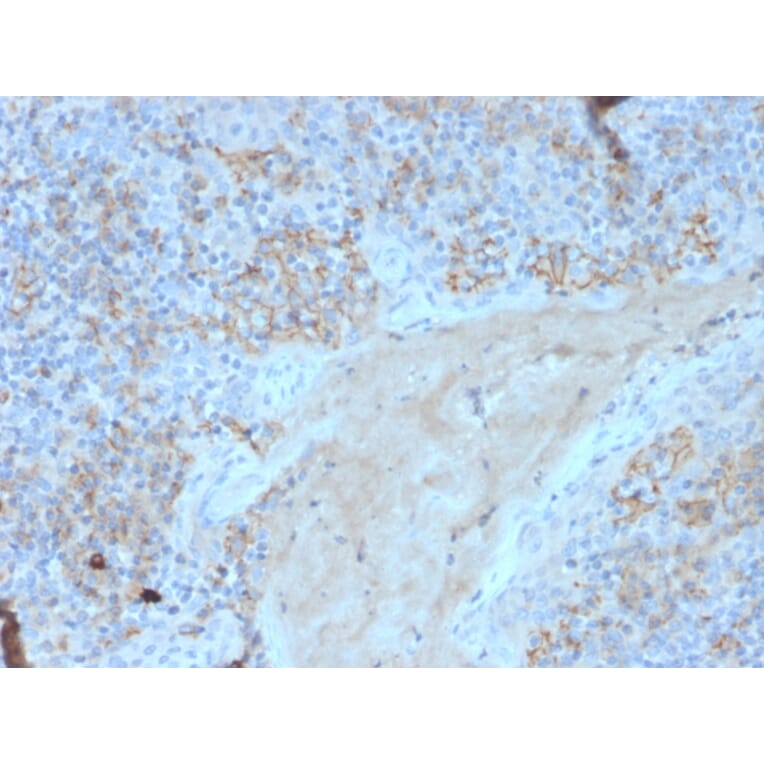 Immunohistochemistry - Anti-Fas Antibody [FAS/3588] (A249021) - Antibodies.com