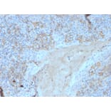Immunohistochemistry - Anti-Fas Antibody [FAS/3588] (A249021) - Antibodies.com