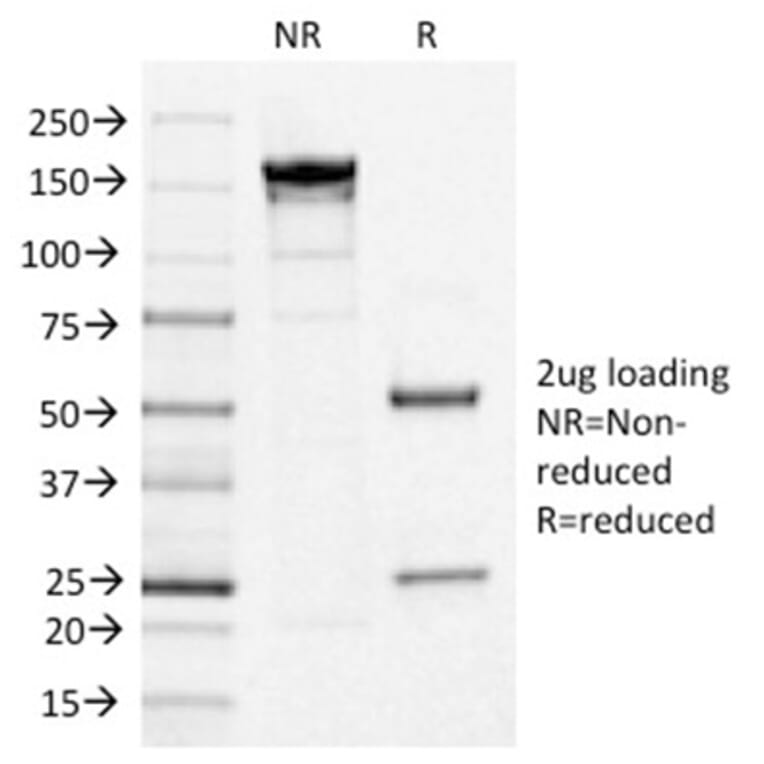SDS-PAGE - Anti-IL3RA Antibody [IL3RA/1531] (A249022) - Antibodies.com