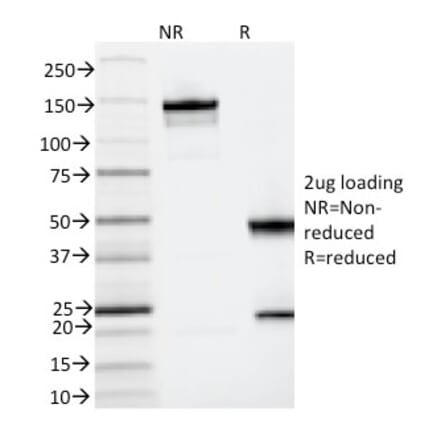 SDS-PAGE - Anti-IL3RA Antibody [IL3RA/2065] (A249023) - Antibodies.com