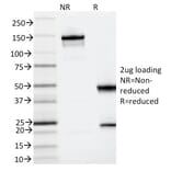 SDS-PAGE - Anti-IL3RA Antibody [IL3RA/2065] (A249023) - Antibodies.com