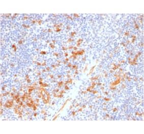 Immunohistochemistry - Anti-IL3RA Antibody [IL3RA/2947R] (A249024) - Antibodies.com
