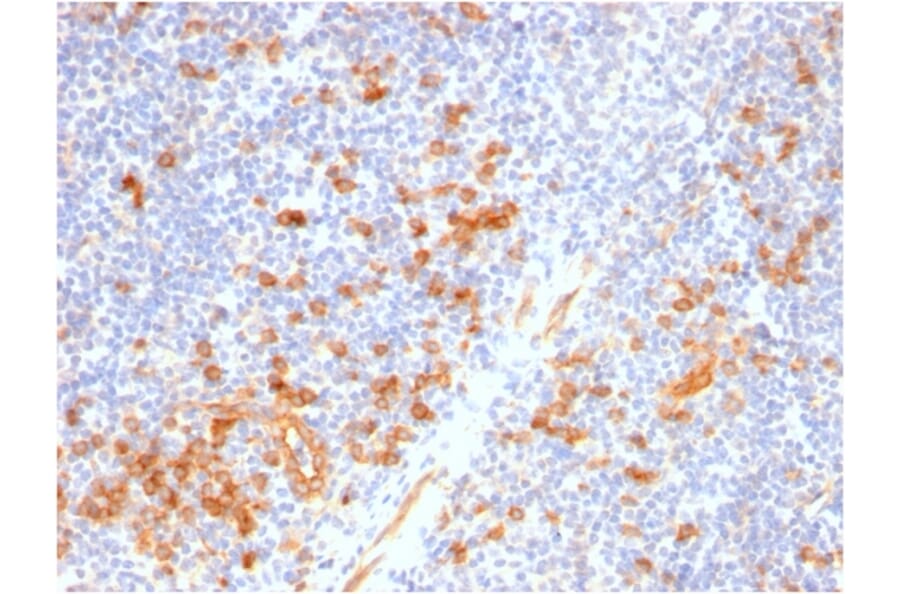 Immunohistochemistry - Anti-IL3RA Antibody [IL3RA/2947R] (A249024) - Antibodies.com