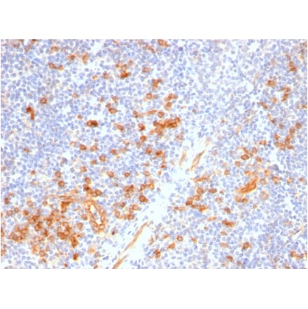 Immunohistochemistry - Anti-IL3RA Antibody [IL3RA/2947R] (A249024) - Antibodies.com