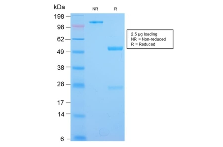 SDS-PAGE - Anti-IL3RA Antibody [IL3RA/2947R] (A249024) - Antibodies.com
