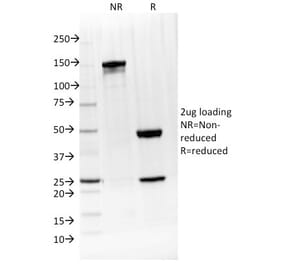 SDS-PAGE - Anti-IL-4 Antibody [IL4/1597] (A249024) - Antibodies.com