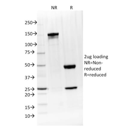SDS-PAGE - Anti-IL-4 Antibody [IL4/1597] (A249024) - Antibodies.com