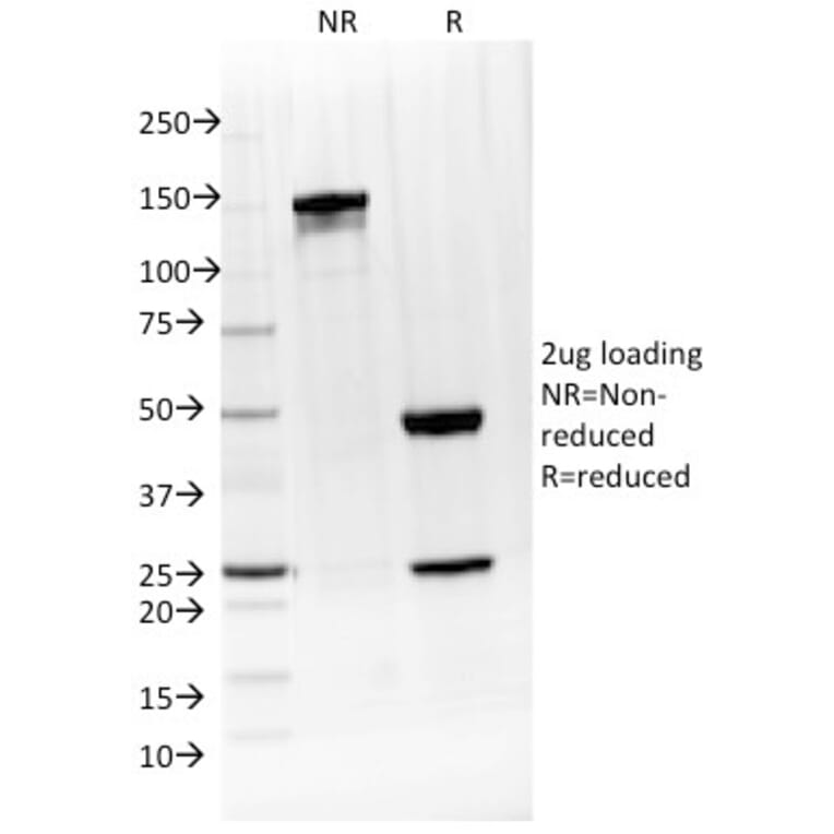 SDS-PAGE - Anti-IL-4 Antibody [IL4/1597] (A249024) - Antibodies.com