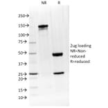 SDS-PAGE - Anti-IL-4 Antibody [IL4/1597] (A249024) - Antibodies.com