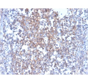 Immunohistochemistry - Anti-Fas Ligand Antibody [FASLG/4455] (A249026) - Antibodies.com