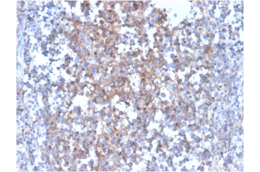Immunohistochemistry - Anti-Fas Ligand Antibody [FASLG/4455] (A249026) - Antibodies.com