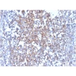 Immunohistochemistry - Anti-Fas Ligand Antibody [FASLG/4455] (A249026) - Antibodies.com