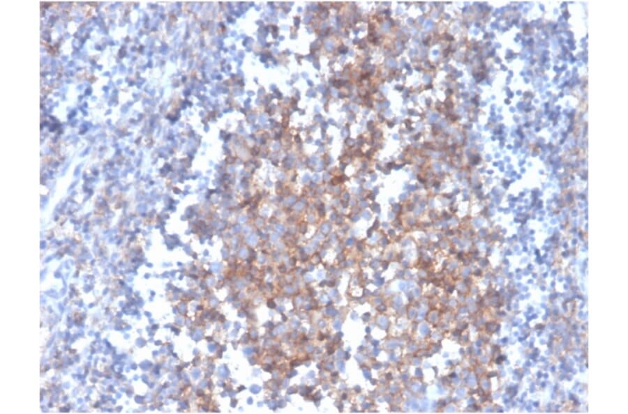 Immunohistochemistry - Anti-Fas Ligand Antibody [FASLG/4455] (A249026) - Antibodies.com
