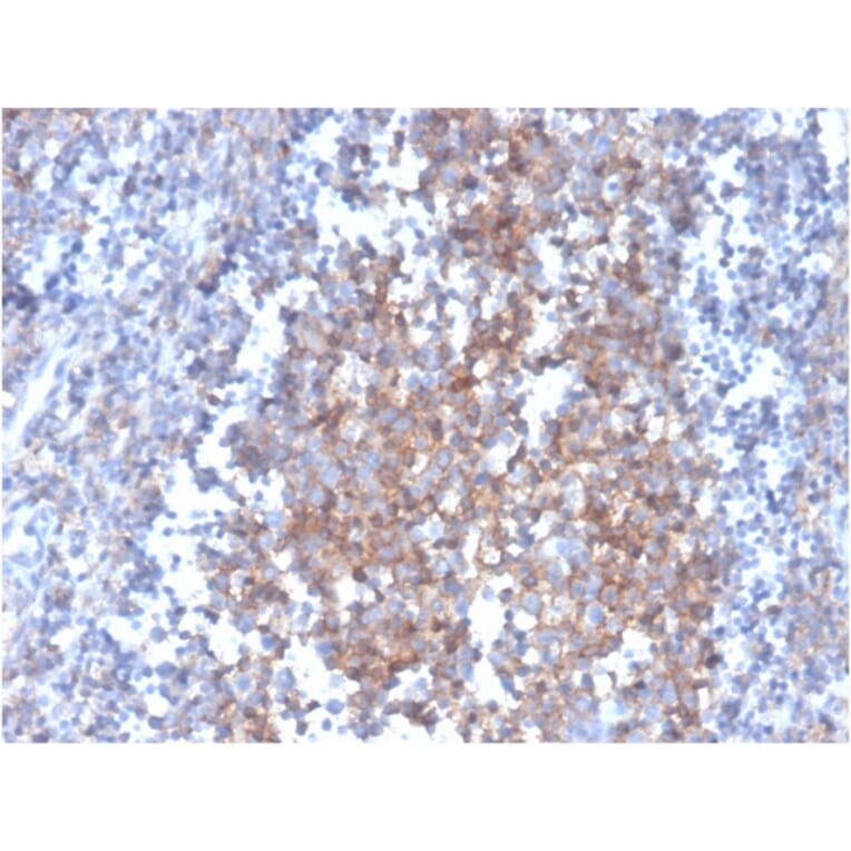 Immunohistochemistry - Anti-Fas Ligand Antibody [FASLG/4455] (A249026) - Antibodies.com