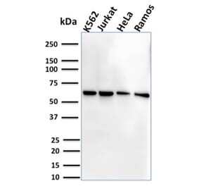 Western Blot - Anti-CD127 Antibody [IL7R/2751] (A249027) - Antibodies.com