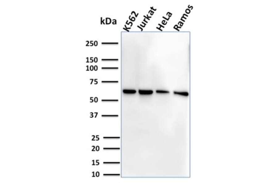 Western Blot - Anti-CD127 Antibody [IL7R/2751] (A249027) - Antibodies.com