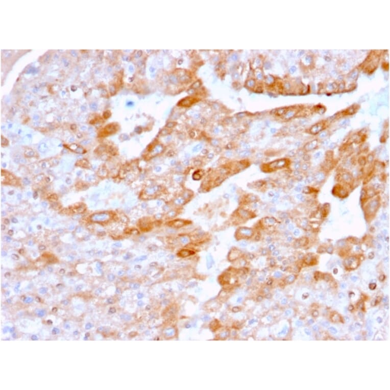 Immunohistochemistry - Anti-CD137 Antibody [4-1BB/3201] (A249029) - Antibodies.com