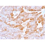 Immunohistochemistry - Anti-CD137 Antibody [4-1BB/3201] (A249029) - Antibodies.com